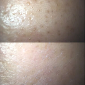 o0349026214241218779