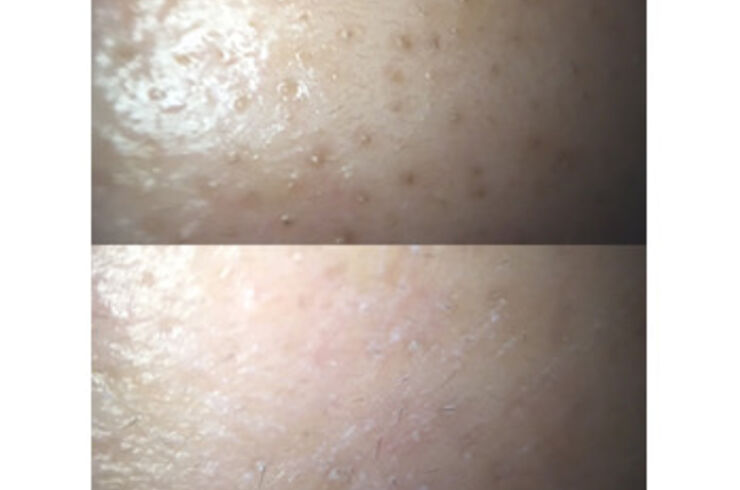 o0349026214241218779